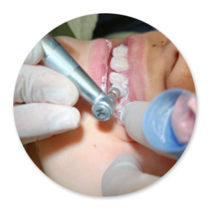 Dentalhygiene Patricia Ried | Kurs 1