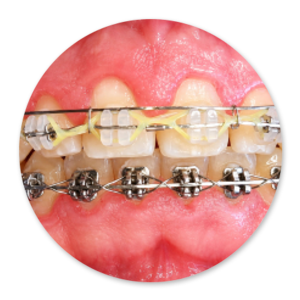 Dentalhygiene Patricia Ried | Kurs 1