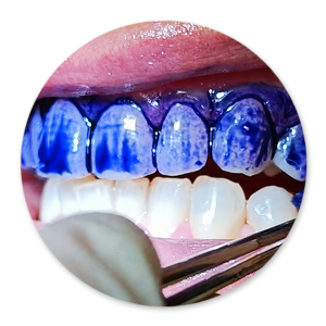 Dentalhygiene Patricia Ried | Kurs 3