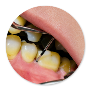 Dentalhygiene Patricia Ried | Kurs 4