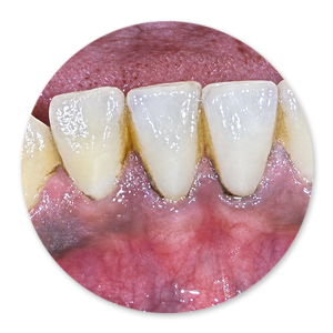Dentalhygiene Patricia Ried | Kurs 6